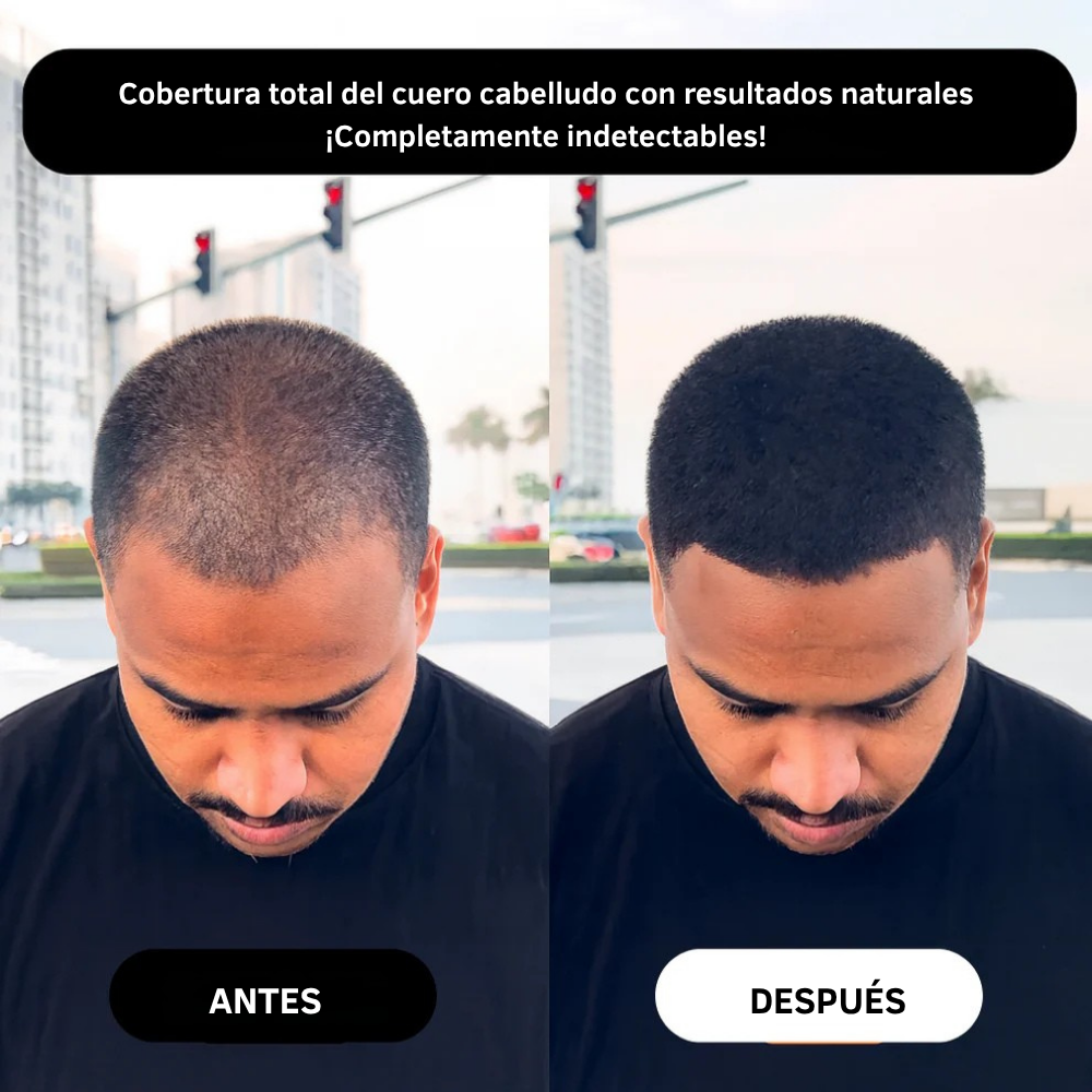 SEVICH Hair Line Powder – Cobertura Rápida de Raíces & Falencias Capilares