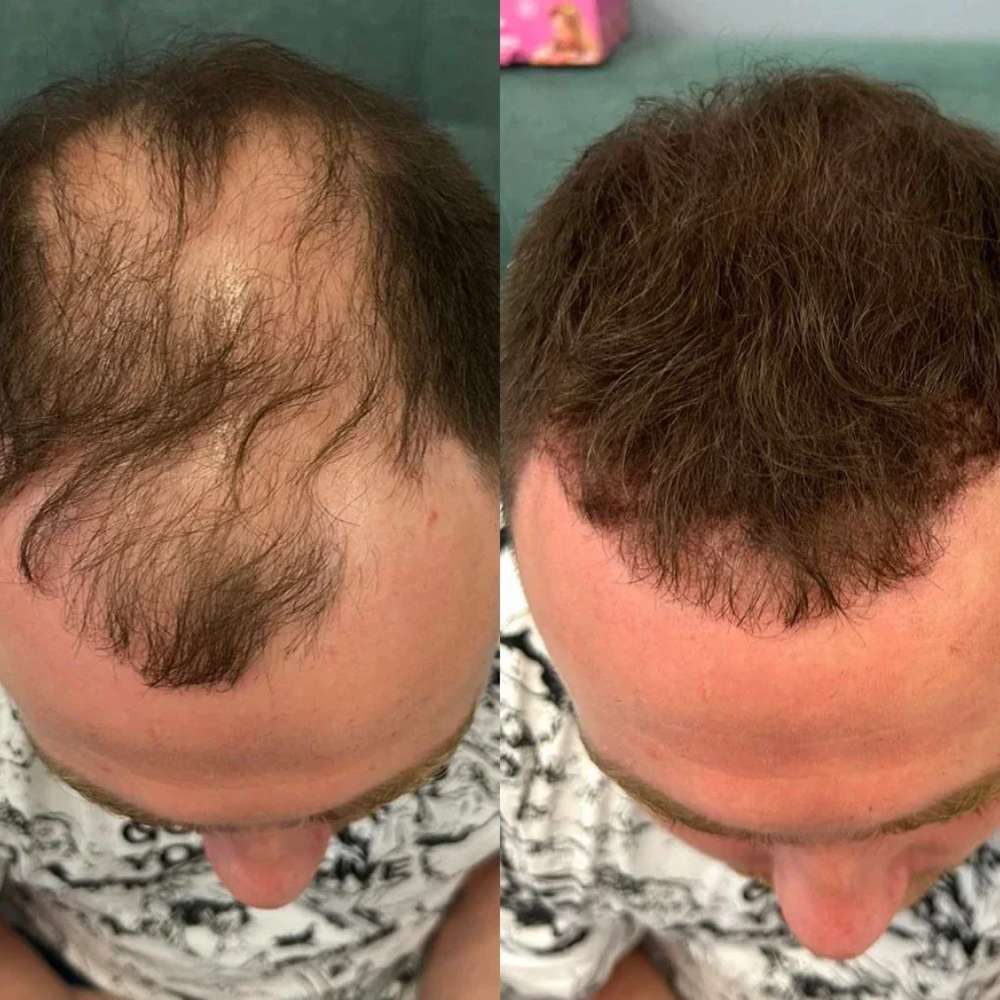 SEVICH Hair Line Powder – Cobertura Rápida de Raíces & Falencias Capilares