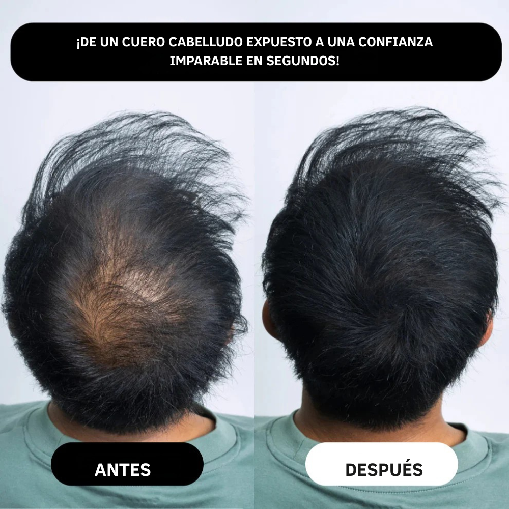 SEVICH Hair Line Powder – Cobertura Rápida de Raíces & Falencias Capilares